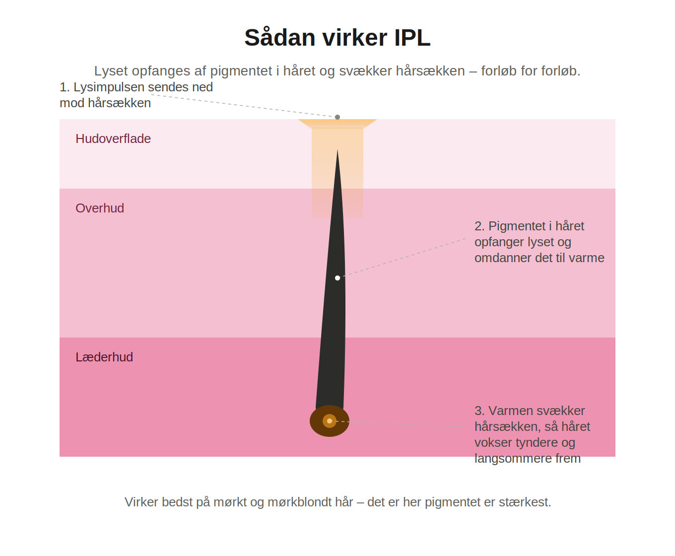 Aveline Lumi – IPL-Haarentferner für Körper und Gesicht