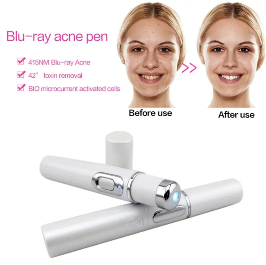 LED-Akne-Stift – Effektive Lichttherapie gegen unreine Haut