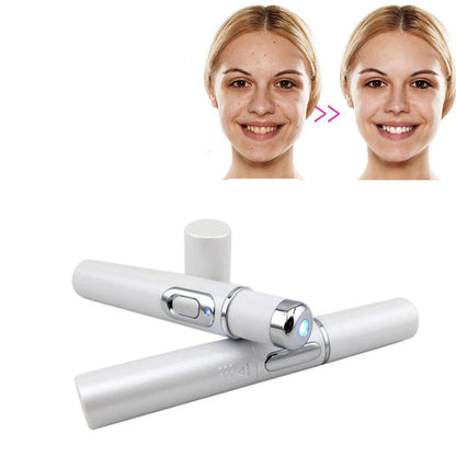 LED-Akne-Stift – Effektive Lichttherapie gegen unreine Haut
