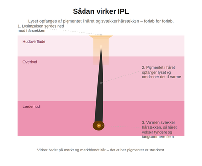 Aveline Lumi – IPL-Haarentferner für Körper und Gesicht